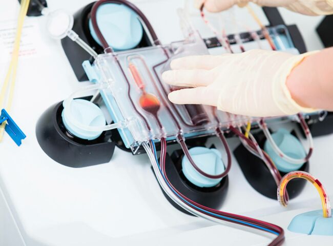 2 Hände bedienen ein Medizinisches Gerät zur Blutreinigung